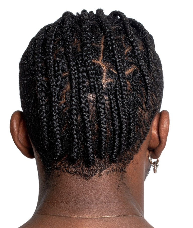 Assistenza pazienti AfroGraft Turkey per domande sul trapianto di capelli afro